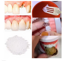 DentFlex Pro™ – Correção Estética Dentária Imediata