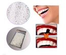 DentFlex Pro™ – Correção Estética Dentária Imediata