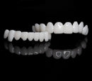 Kit 2 Lente Dental White - Snap On Smile - Sorriso Perfeito com Conforto e Praticidade