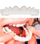 Kit 2 Lente Dental White - Snap On Smile - Sorriso Perfeito com Conforto e Praticidade