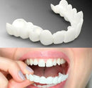 Kit 2 Lente Dental White - Snap On Smile - Sorriso Perfeito com Conforto e Praticidade
