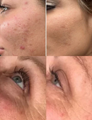 FaceLiss™ -  Escova de Massagem Facial – Ativa a Circulação Suaviza Linhas e Modela